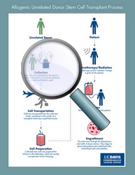 Allogeneic unrelated stem cell transplant process - CLICK HERE TO ENLARGE ILLUSTRATION