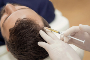 Injection treatment for hair loss (c) UC Regents. All rights reserved.