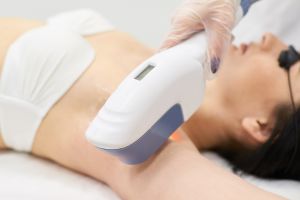 Laser underarm hair removal (c) UC Regents. All rights reserved.