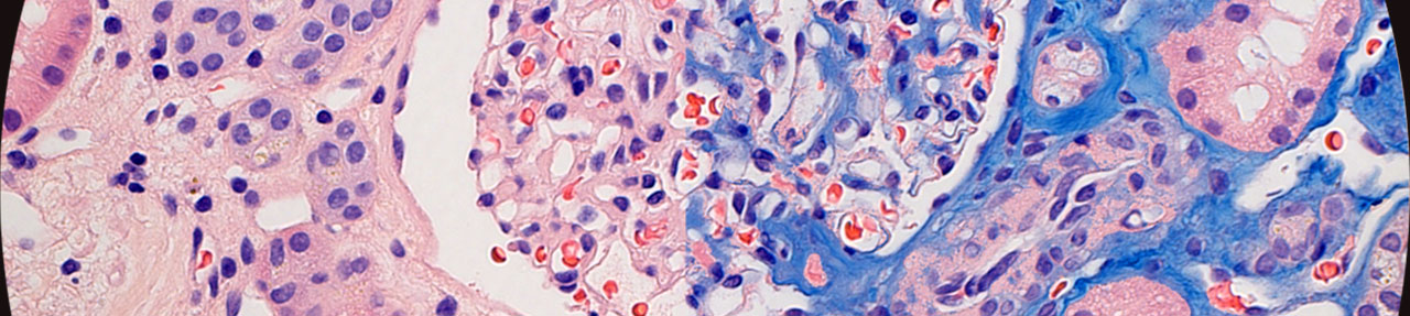 DUET Kidney image