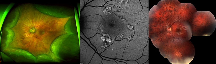 opthalmic Imaging referral