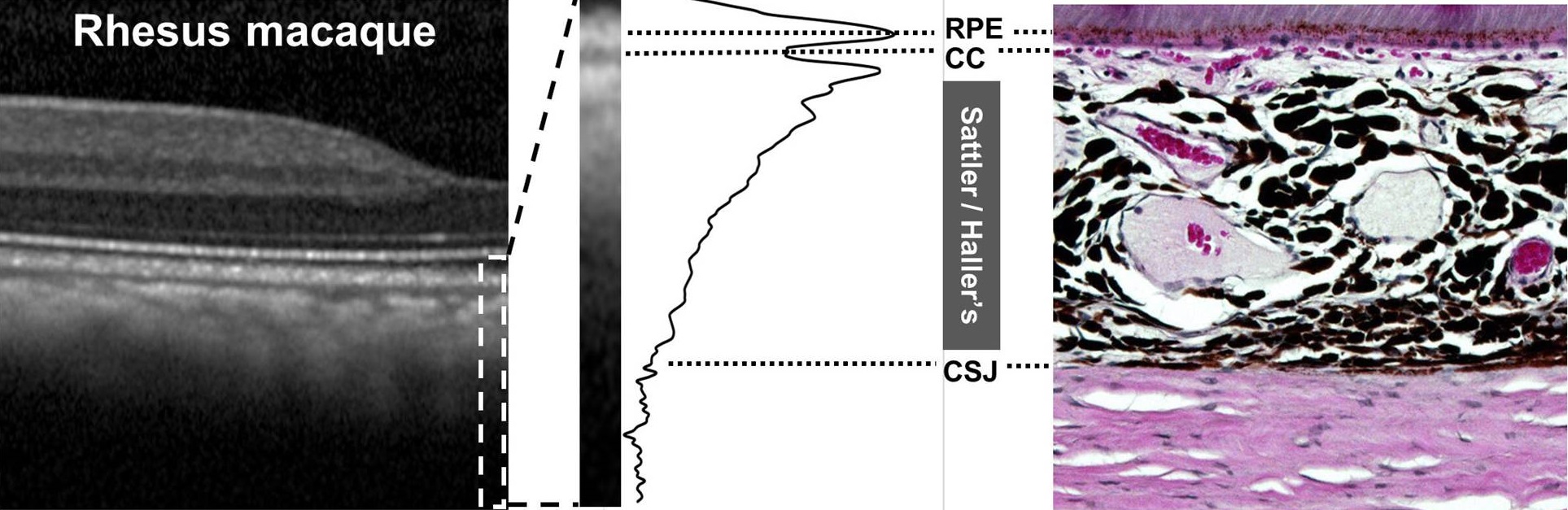 Primate Research in Macular Degeneration