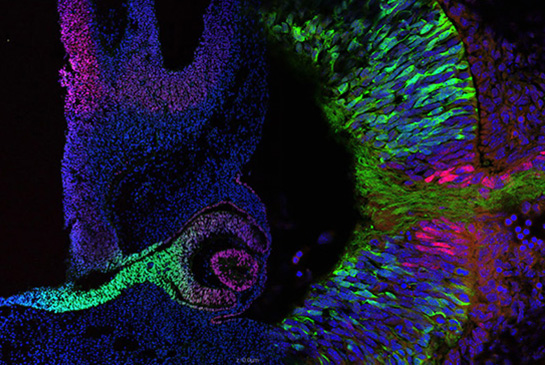 Cell signaling in eye morphogenesis, research image from the Brown Lab