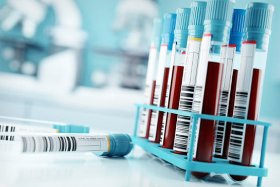 blood test samples in tubes, stock image