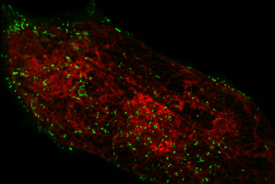 Image taken using the Zeiss LSM 880 with Airyscan microscope