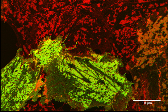 Image taken using our Zeiss LSM 880 with Airyscan microscope