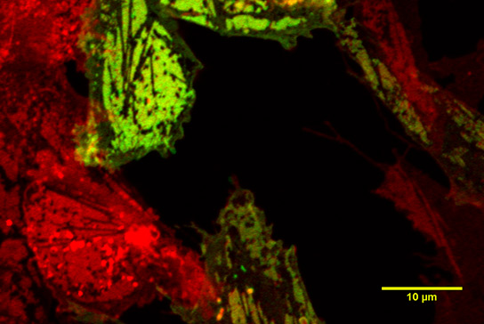 Image taken using our Zeiss LSM 880 with Airyscan microscope