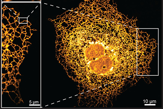 Images taken using our Zeiss LSM 880 with Airyscan microscope