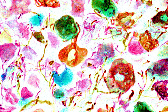 Griffith lab research image