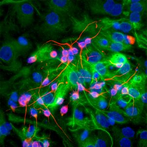 Stem cells differentiating into neurons and glia