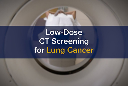 Low-Dose CT Screening for Lung Cancer