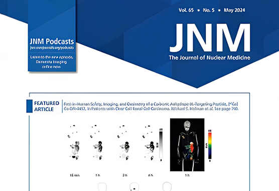 Total-Body Perfusion Imaging with [11C]-Butanol