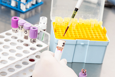 Flow Cytometry