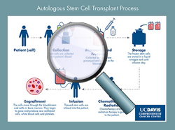 Autologous transplant