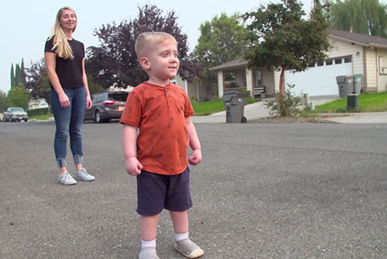 Remi, who had fetal surgery for spina bifida, walks and runs