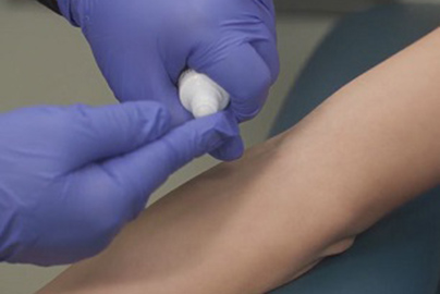 Gloved hands applies cream to an arm