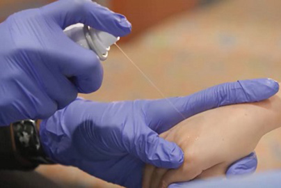 Someone sprays onto skin