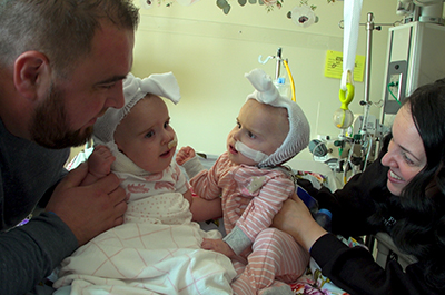 Parents with their separated twins.