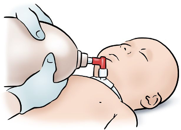 provide rescue breathing to baby
