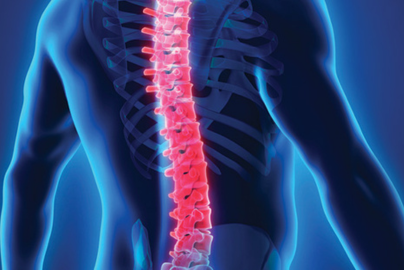 A graphic of a human back is shown with the spin highlighted a bright color.