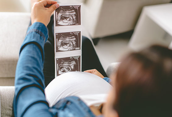 Pregnant woman looking at an ultrasound