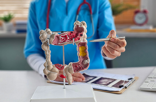 Colorectal surgeon showing patient figure of the bowl anatomy.