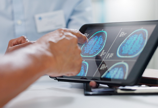 Health care providers looking at images of brain for DBS.