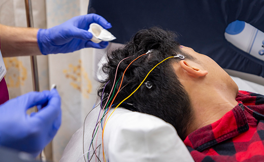 Patient's head with electrodes for EEG test.