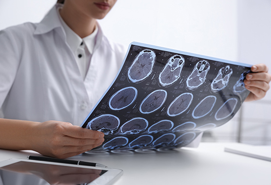 Neurosurgeon looking at images of brain for epilepsy surgery.