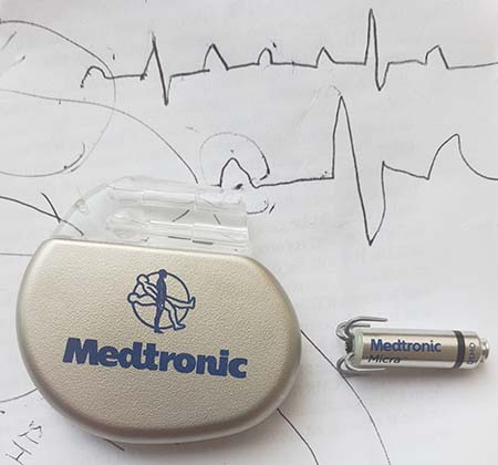 A traditional pacemaker, left, compared to the leadless pacemaker.