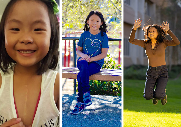 Annabelle showing her scar (left) seated wearing a blue shirt with 'hearts of gold' (center) wearing a brown shirt and black jeans jumping up outside on a lawn