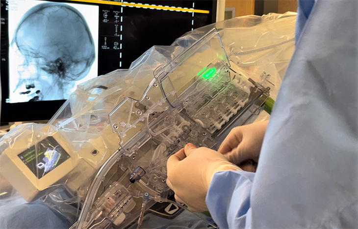 Surgeon working with robot machinery while seeing skull on screen