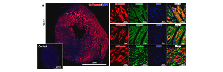 series of staining images of heart muscle