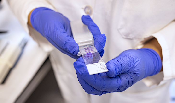 A pair of hands with blue gloves holds a slide with writing and pink dots. 