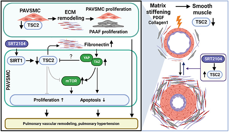 Schematic chart of arteries in the lungs