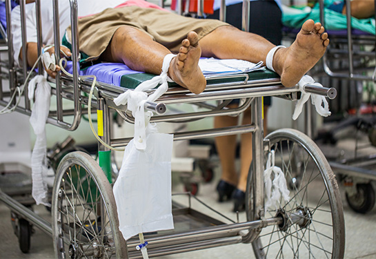 Person laying on gurney wearing hospital gown with legs in restraints