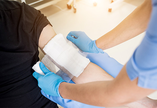 Nurse dressing a hand burn wound