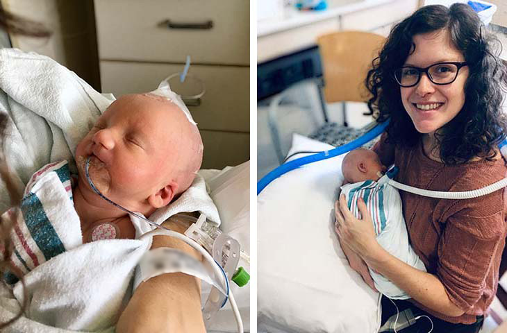 A baby with tubes in his mouth being held by a woman. 