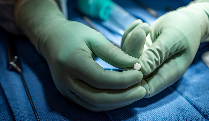 A surgeon holds the small, white cork-shaped CartiHeal implant in her gloved hands.