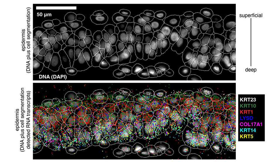 Skin cells are pictured in these powerfully enhanced images. Both images show skin cells ringed in white borders. The bottom image notes gene activity as multi-colored dots.