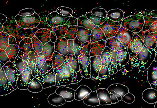 Skin cells are pictured in these powerfully enhanced images. The bottom image notes gene activity as multi-colored dots.