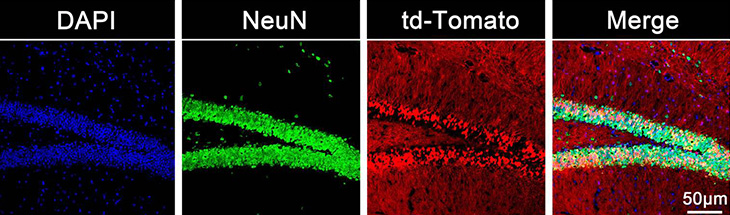 Four slides of wide distribution of transfected cells in the hippocampus.