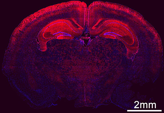 Widespread of transfected cells in the brain by in utero delivery Cre mRNA 