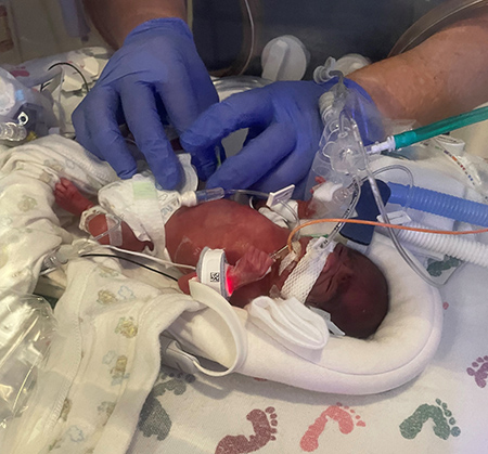 Baby in the NICU