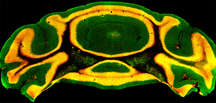 A slide of mouse cerebellum cells, stained with orange fluorescence. 