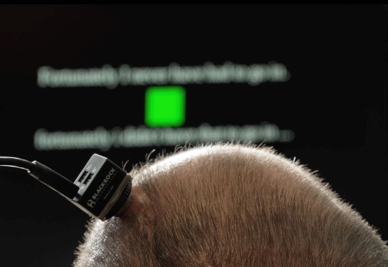 An investigational device is on top of a man's head with a computer screen in the background