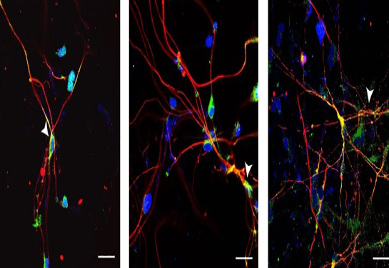 chromosome activation