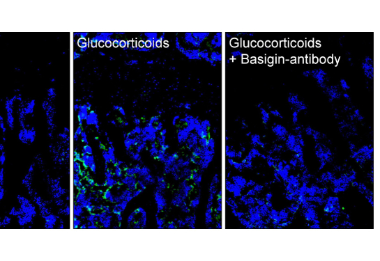 Images of Basigin in bone/bone marrow of mice treated with Placebo, Glucocorticoids or Glucocorticoids and Basigin Antibody.