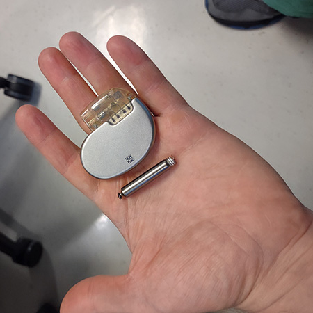 Leadless pacemaker in palm of the hand