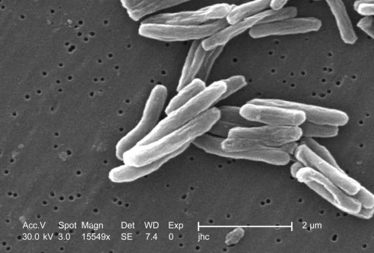 A scanning electron microscope image of rod-shaped bacteria against a grey background. 